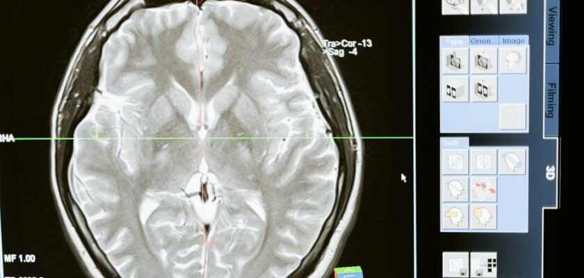 Mythe : Nous n’utilisons que 10 % de notre cerveau – Démystifions cette idée !