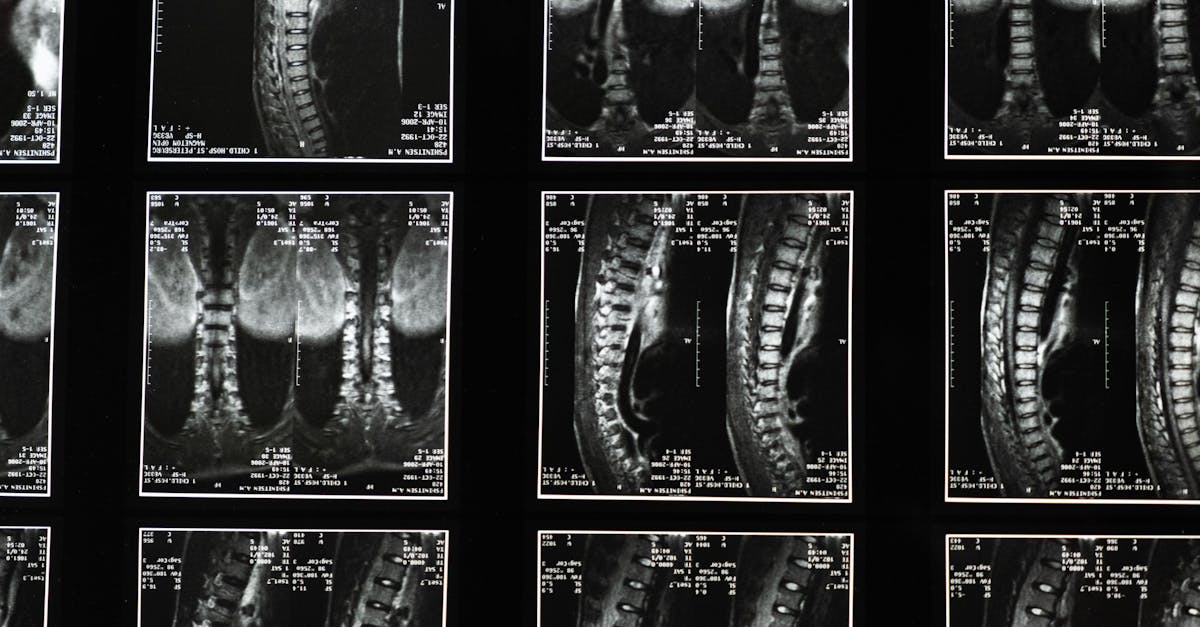 explorez les blessures narcissiques, leurs causes profondes et leurs impacts sur la psychologie. comprenez comment elles se manifestent et les stratégies pour les surmonter, afin de favoriser une santé mentale équilibrée.