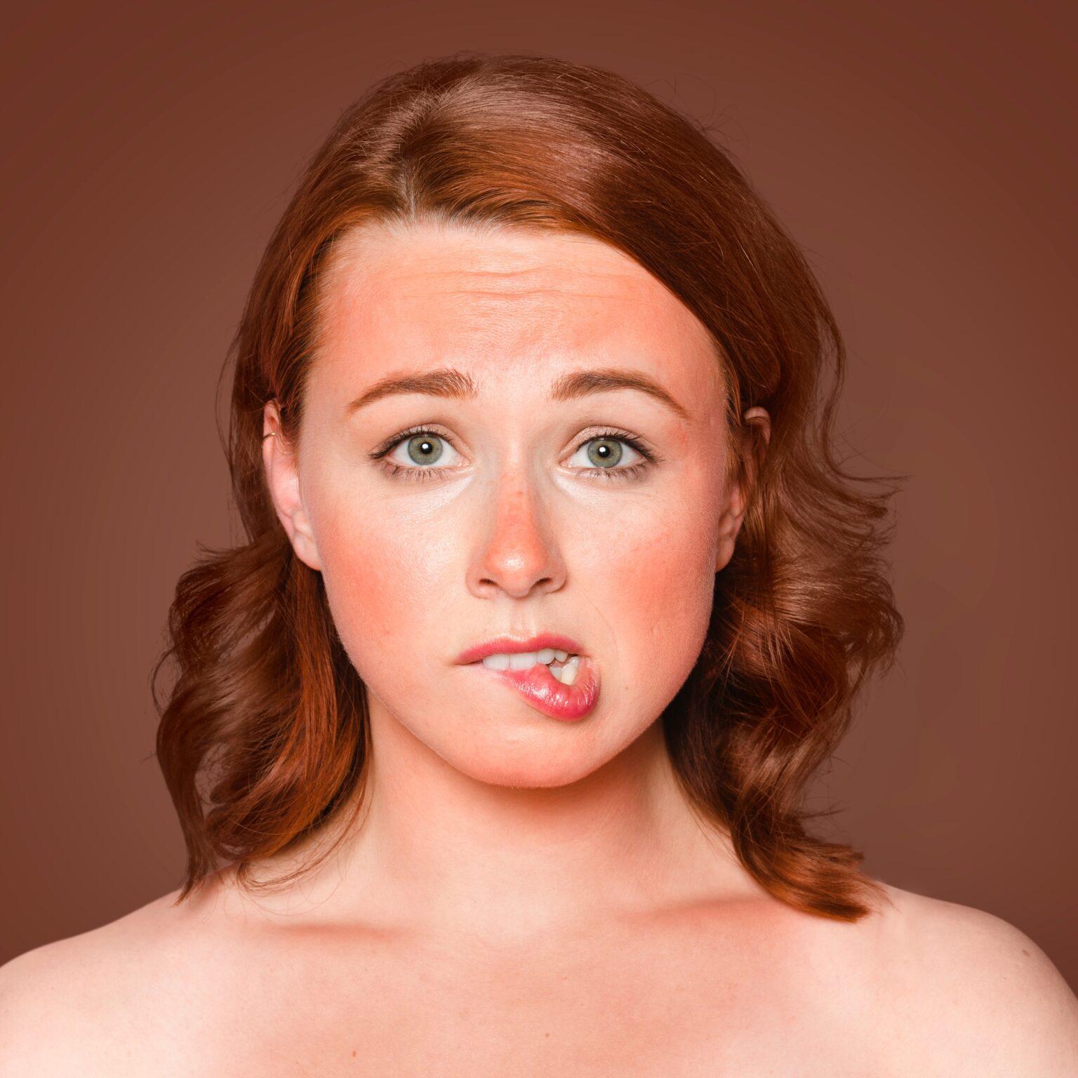 Qu’est-ce que la dermatophagie : 5 façons de savoir comment arrêter de mordre la peau des doigts Woman with sunburnt skin biting her lips