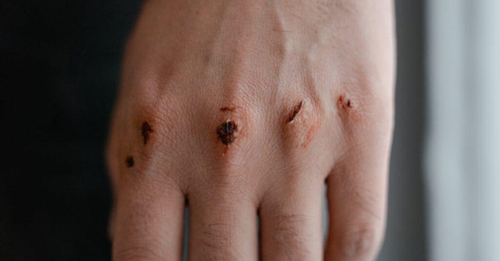 découvrez les impacts du trauma sur la santé mentale et physique, ainsi que des stratégies de guérison et de résilience. apprenez à reconnaître les symptômes et à trouver un soutien adapté pour surmonter vos expériences traumatiques.