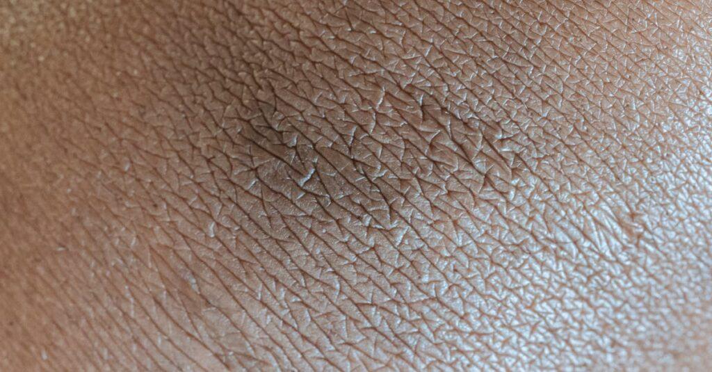 Comment identifier les signes d’un trouble bipolaire chez une personne ? découvrez les symptômes du trouble bipolaire pour mieux comprendre cette maladie mentale et reconnaître ses signes précoces.