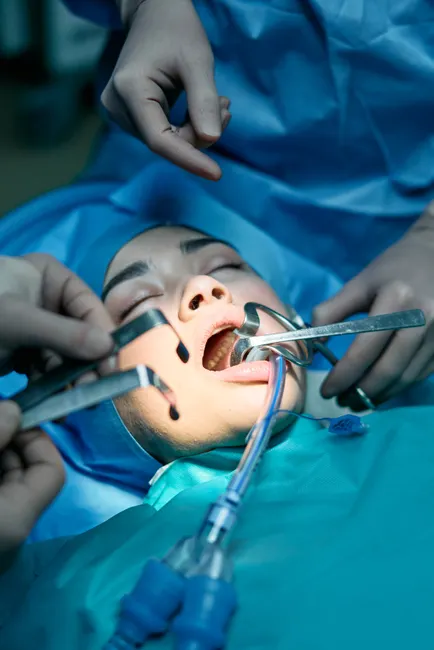 Close-up of a dental surgery in an operating room with medical professionals at work.