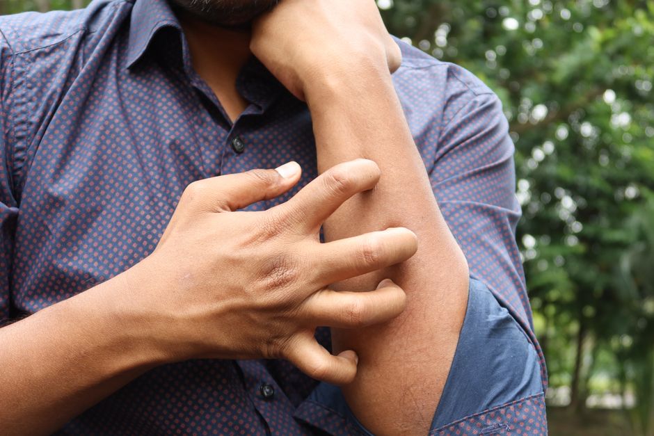 Formication : quand la peau donne l’impression que des insectes rampent A man in a blue shirt scratching his arm outdoors, highlighting skin irritation.