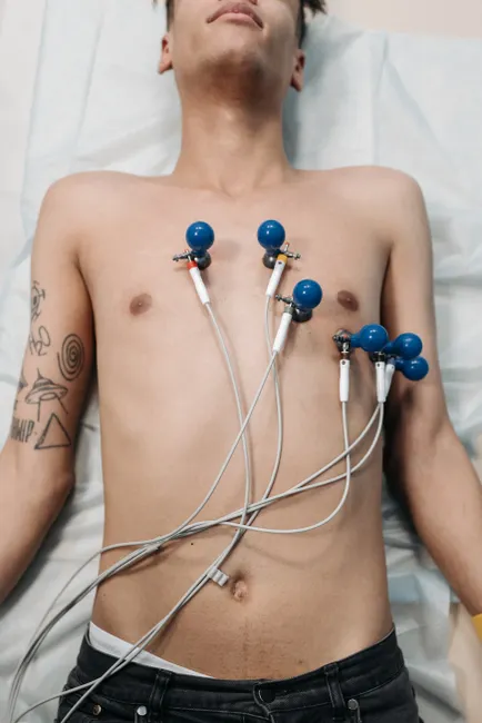 A young man lying down for an ECG procedure with electrodes attached to his chest.