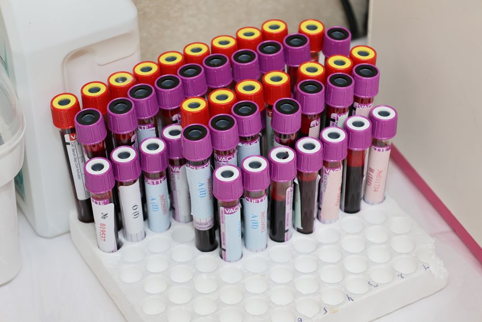 Rows of blood vials in a laboratory setting, ready for analysis.
