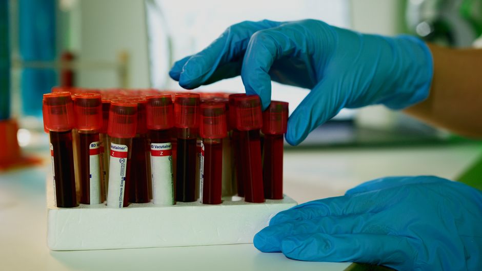 A lab technician handles blood vials in a laboratory setting, showcasing medical research.