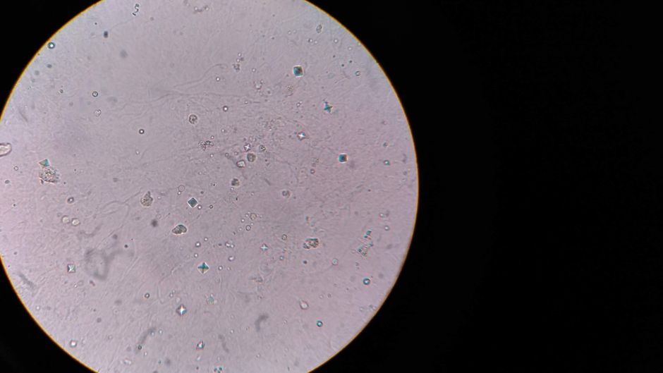 Close-up view of bacteria under a microscope, showing cellular structures.